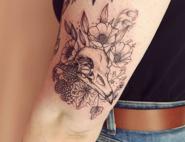 Newcastle tattoo removal